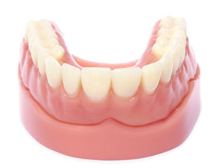 Implant-Retained Dentures