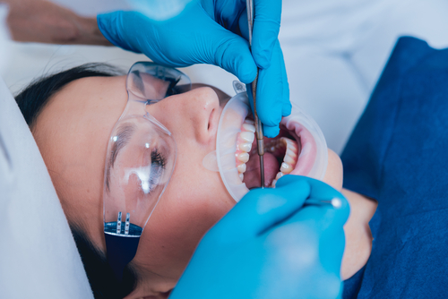 Root Canal Surgery in Las Vegas