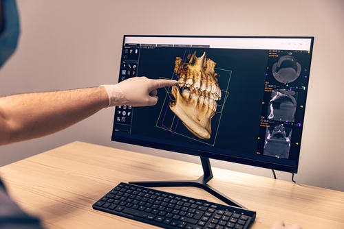 CBCT Scan for Dental Implants in Las Vegas, NV | Call Today!